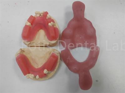 Cina Vibrante rosso gomito per denti superiori o inferiori finitura lucida Peso leggero in vendita