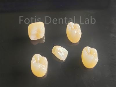 China Apelación estética de porcelana completa con capas de zirconia ideal para puentes de coronas en venta