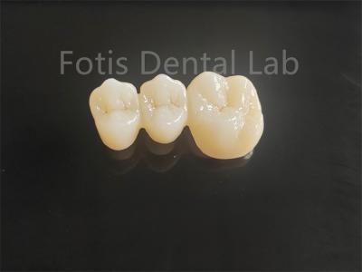 China High Strength Porcelain Layered Zirconia For Long Lasting Dental Bridges for sale