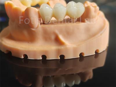 Cina Materiale ceramico ad alta durezza a base di zirconia per applicazioni dentali in vendita