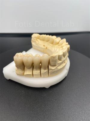 China Boa performance Dental Zirconia Multilayer A solução cerâmica definitiva à venda