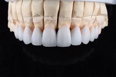 Cina Resistenza alle crepe Zirconia Multilayer Ceramica Soluzione definitiva per l'efficienza industriale in vendita