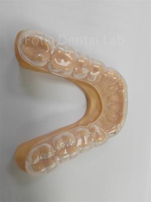 China Ergonomisch Hard Soft Occlusal Guard Zachte Tanden Guard Langdurig Gebruik Te koop