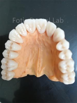 Chine Zirconia multicouche avancée pour une résistance supérieure à l'usure et à la corrosion à vendre