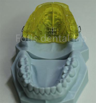 中国 Customizable Orthodontic Retainer for China Dental Lab 販売のため