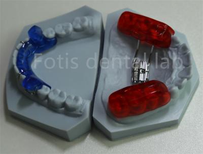 China Effective Tooth Retention Dental Lab Orthodontic Space Keeper for Expanding Teeth zu verkaufen