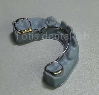 중국 China Dental Lab Orthodontic Retainer For Teeth Expansion 판매용