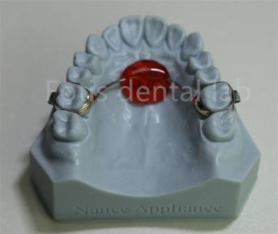 China Dental Lab Orthodontic Palatal Expander Affordable and Compatible with Most Treatments for sale