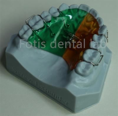 Chine Versatile and Comfortable Orthodontic Retainer Expander for Effective Teeth Retention à vendre