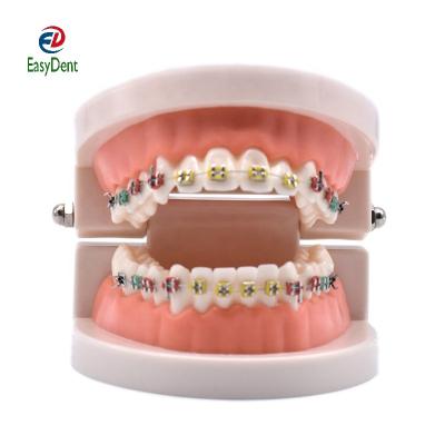 China Teaching Dental Orthodontic Model With Ortho Metal Curing Ceramic Arch Bracket Wire Buccal Tube Ligation Bonds Dental Dentist Tools Lab for sale