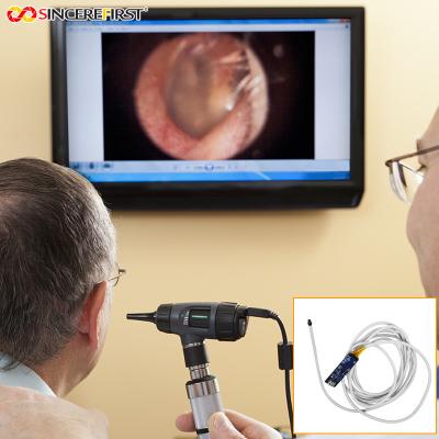 China 5mm 1080p 60fps Otoscope Ear Camera Endoscope Endoscopy Camera Module for sale