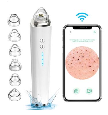 China Acne Treatment Acne Treatment Pore Detergent Blackhead Remover Vacuum With Camera for sale