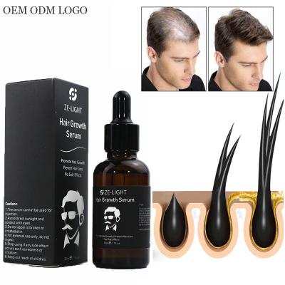 China OEM 30ml Loss Prevention Smoothing Women Human Fast Private Label Oil Hair Loss Serum Organic Hair Growth Serum for sale