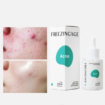 China Skin Revitalizer OEM ODM Acne Scar Marks Removal Treatment Whitening Moisturizing Effective Face Repair Care Serum for sale