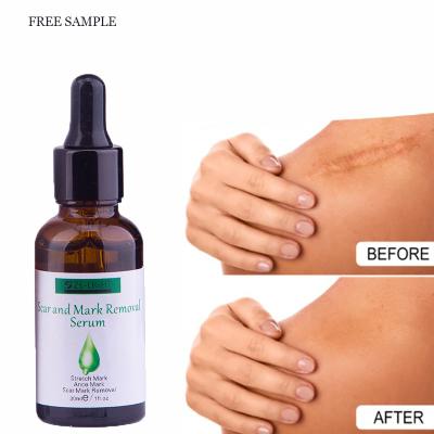 China Skin and Scar Removal Serum Stretch Mark Skin Revitalizer OEM Private Label Scar Repair Serum for sale