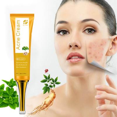 China Acne Pimple Removal Best Anti Acne Free Sample Facial Cream Whitening Treatment Private Label for sale