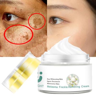 China Whitening Amazon Supplier Private Label Skin Whitening Spot Treatment Freckle Face Whiten Cream for sale