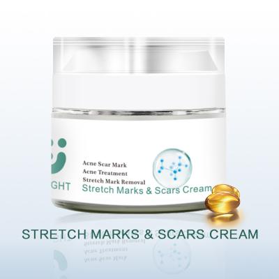 China Wholesale Customization Skin Whitening Acne Treatment Stretch Mark Scars Removal Cream for sale