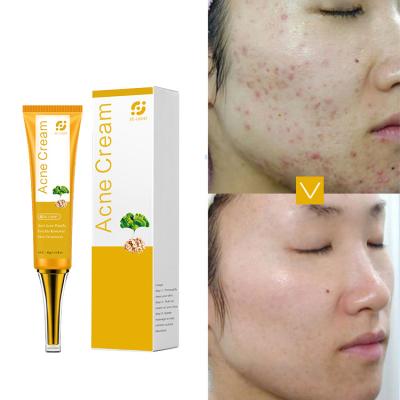 China Best Anti Acne Scar Pimple Removal Facial Cream Whitening Korean Treatment Private Label Face Acne Cream for sale