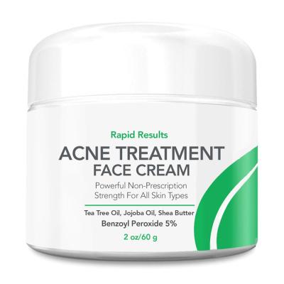 China Natural Anti-Wrinkle Private Label Skin Care Plant Extract Acne Treatment Face Cream For Sensitive Skin 60g for sale