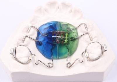 China FDA Pendulum Appliance Orthodontics Pendulum Ortho Appliance Customizable for sale