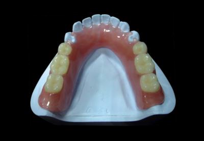 China Pink Removable Partial Acrylic Denture Temporary Acrylic Partial Denture for sale