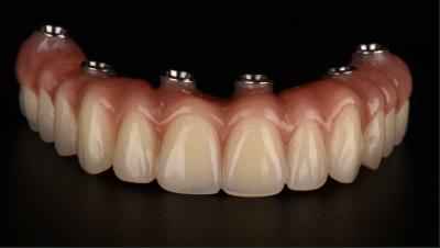 China All On X Implant Supported Dentures Titanium Bridge Dental CE FDA Approval for sale