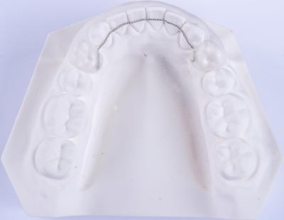 China Retentor de alambre de la lengua no extraíble Retentores de ortodoncia para enderezar los dientes en venta