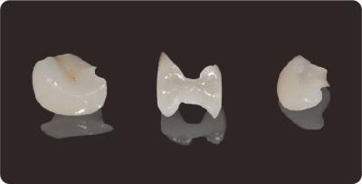 China Accuracy Dental Inlays And Onlays Lithium Disilicate Milling Onlay Veneer for sale