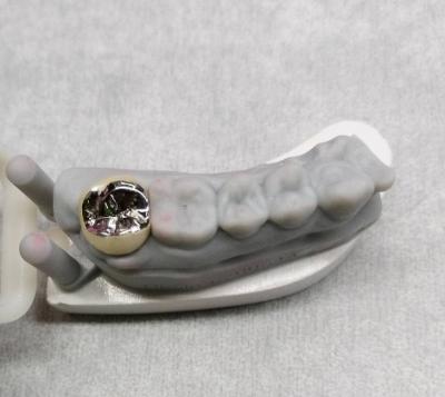 China Coroa de metal de liga semi-preciosa e coroa temporária do dente de ponte à venda