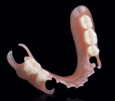 China Valplast Flexible Partial Removable Dentures Precision Attachment In Prosthodontics for sale