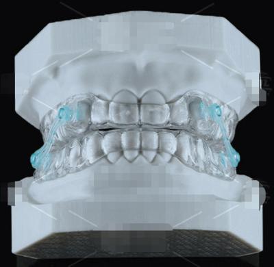 China Transparent Erkodent Silensor Orthodontics Appliance Anti Snoring Mouthpiece for sale