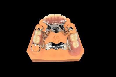 China Implantes Dentários Dentes Removíveis Dentes Vitallium Metal Dentes Parciais à venda