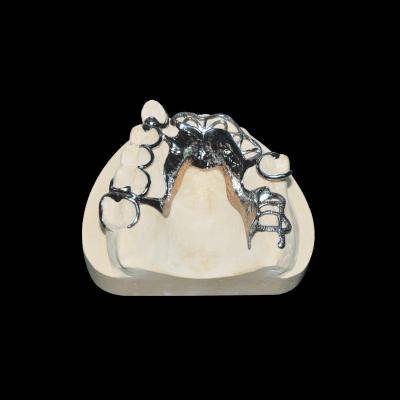 China High Accuracy Vitallium Framework Removable Tooth Denture Class 2 for sale