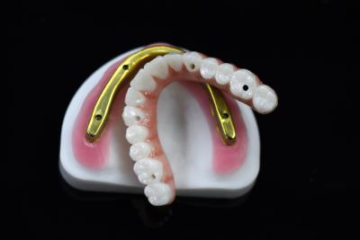 China Customizable Dental Zirconia Bridge Over Milled Implant Bar High Accuracy for sale