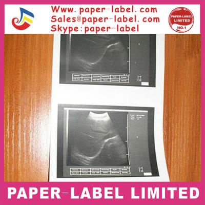 China Plotting paper factory supply sony printer up-110s ultrasound paper for sale