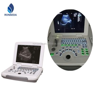 China High Elements Laptop Ultrasound Scanner Machine For Pregnancy Scanning&Cardiology 12 Inch High Resolution LED for sale