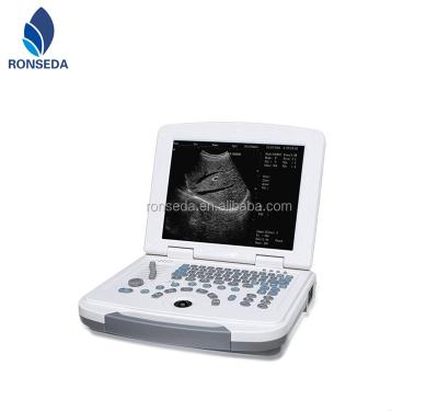 China Optional ultrasonic diagnostic probes of digital ultrasound scanner used in clinic 12 inch high resolution LED for sale