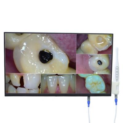 China Panorama Screen Wireless Wifi Ultrathin Intraoral Camera Dental Unit for sale