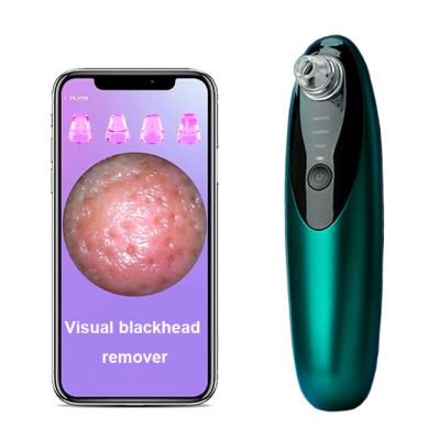 China New Hot Selling Acne Remover Wifi Acne Treatment New Acne Nose Remover Wifi Mini Bubble Instrument Mini Camera Bubble Instrument Vacuum Blackhead Remover for sale