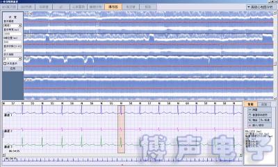 China BORSAM PC Based EKG Analyzer Holter ECG Software System for sale