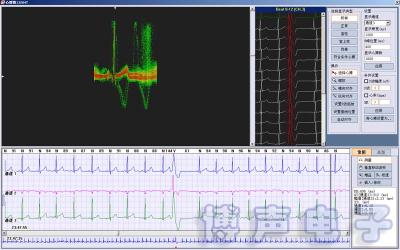 China Holter ECG Software 3/12 Channels 24-Hours Ambulatory ECG Holter Monitor HRT, T-wave alterans & HRV for sale