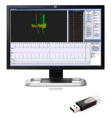 China 24 Hours ECG Holter with Holter ECG Analysis Software iTengo (replace DMS/DL900) for sale