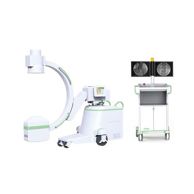 China High Quality Metal Hospital Imaging Equipment C-arm Fluoroscopy Machine for sale