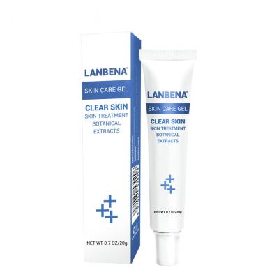 China LANBENA Acne Treatment Acne Treatment Gel Repair Acne Blackhead Remover Acne Spots Skin Care Cleansing Cream for sale