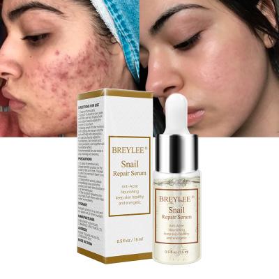 China BREYLEE Skin Revitalizer Snail Repairing Serum Anti Acne Rejuvenation Marks Moisturize Nourishing Acne Treatment Face Liquid Skin Care for sale