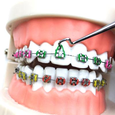 China Colorful Orthodontic Elastic Ligature Ring Elastic Ligatures Dental Bracket Hospital/Clinic/Dentist/Orthodontic Smile Link for sale