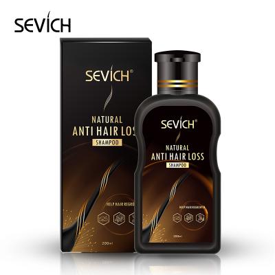 China Private Label Hair Care Anti Hair Loss Shampoo Natural Brazilian Natural Hair Shampoo Anti Hair Loss Shampoo for sale