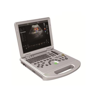 China Full Color Metal BT-UDC60PLUS Portable 4D 4D Ultrasound Machine Cheap Medical Digital Doppler Prices for sale