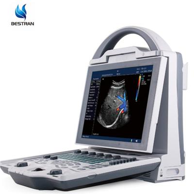 China BT-UD61 2D Full Digital Metal Color Doppler System Ultrasound Instruments Portable Pregnancy Ultrasound Scanner Machine for sale